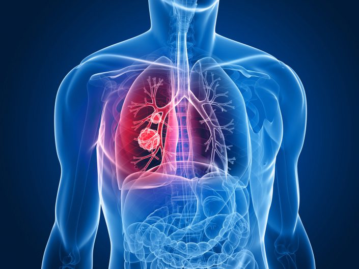 Cuidar tus pulmones también es salud preventiva
